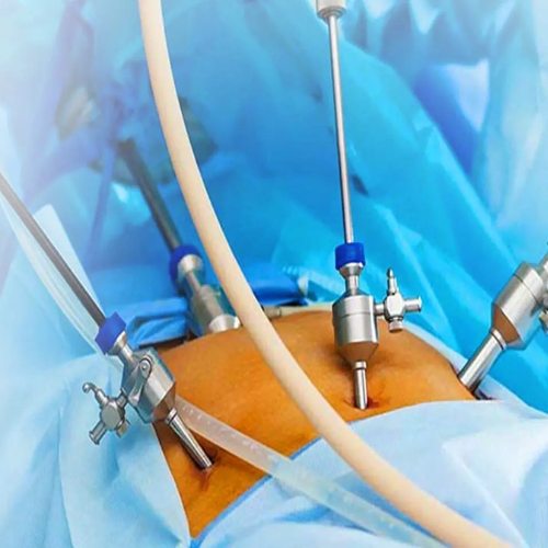 Advanced laparoscopic surgeries